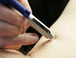 İnsülin direnci Alzheimer riskini arttırıyor