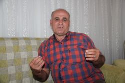 Fil hastası genç kız yardım bekliyor