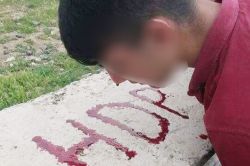 Dövdükleri çocuğun kanıyla HDP yazdılar