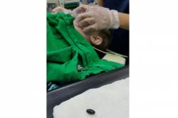 Tesbih tanesini yutan bebek hayata döndürüldü