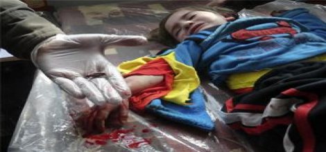 Öldürülüyoruz, ayaklanıyoruz, susuyorsun!-video