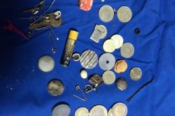 Çocukların yuttukları cisimler görenleri hayrete düşürüyor video