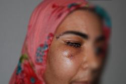 PKK’lilerin açtığı ateşle yaralanan kadın konuştu video